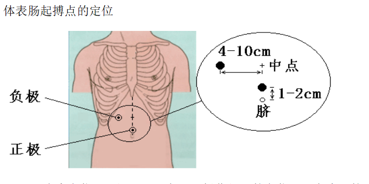 胃肠动力治疗仪起搏点定位
